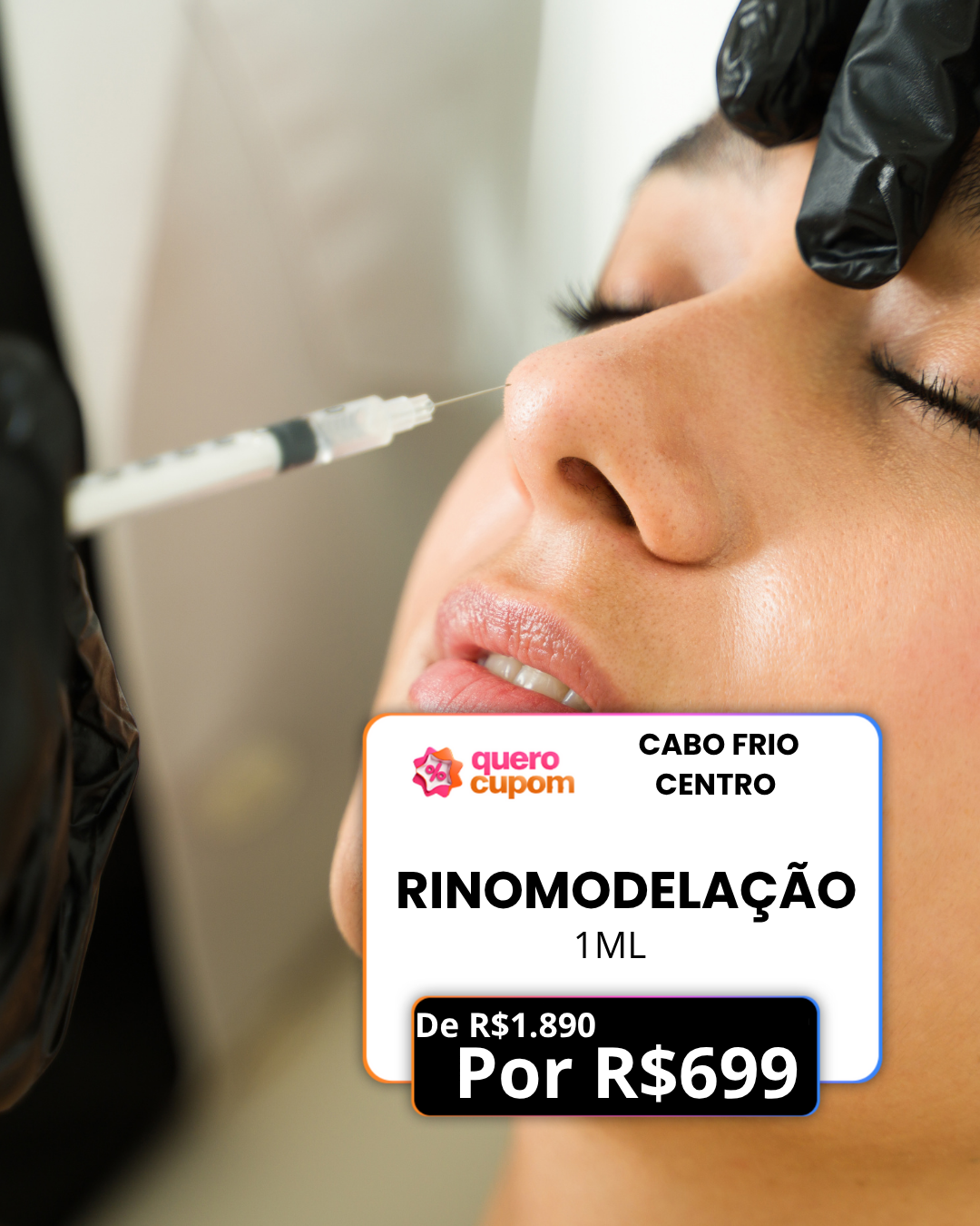 TRANSFORME SEU NARIZ SEM CIRURGIA! RINOMODELAÇÃO 1ML
