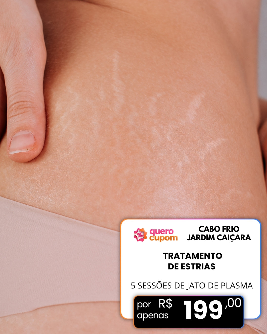 ACABE COM AS ESTRIAS DE UMA VEZ POR TODAS! 5 SESSÕES