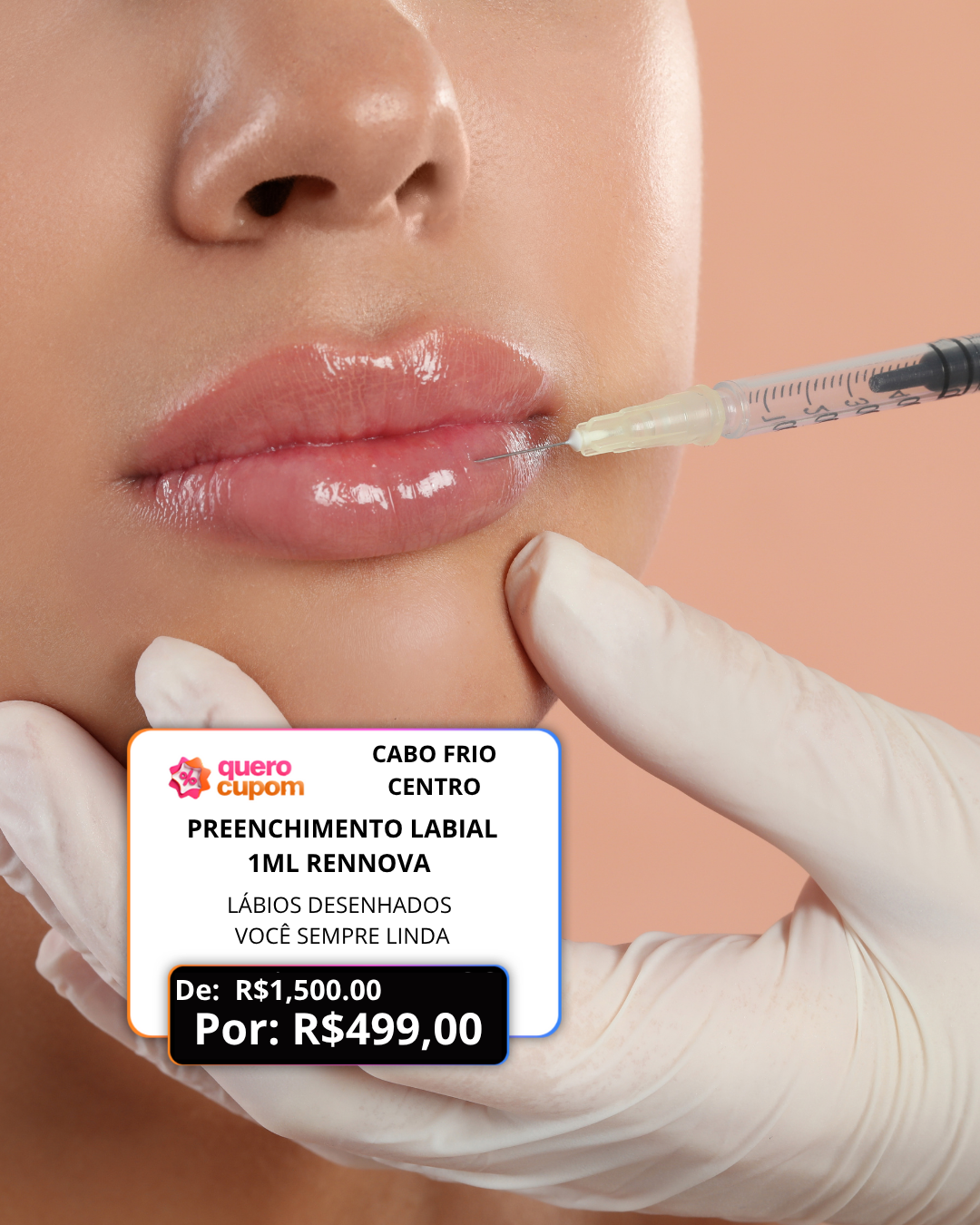 PREENCHIMENTO LABIAL 1ML RENNOVA - LÁBIOS DESENHADOS VOCÊ SEMPRE LINDA