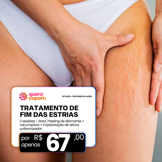 FIM DAS ESTRIAS:(2 sessões) peeling de diamante + vacumpluss + implantação de ativos uniformizador . Valor de R$67,00 (área)