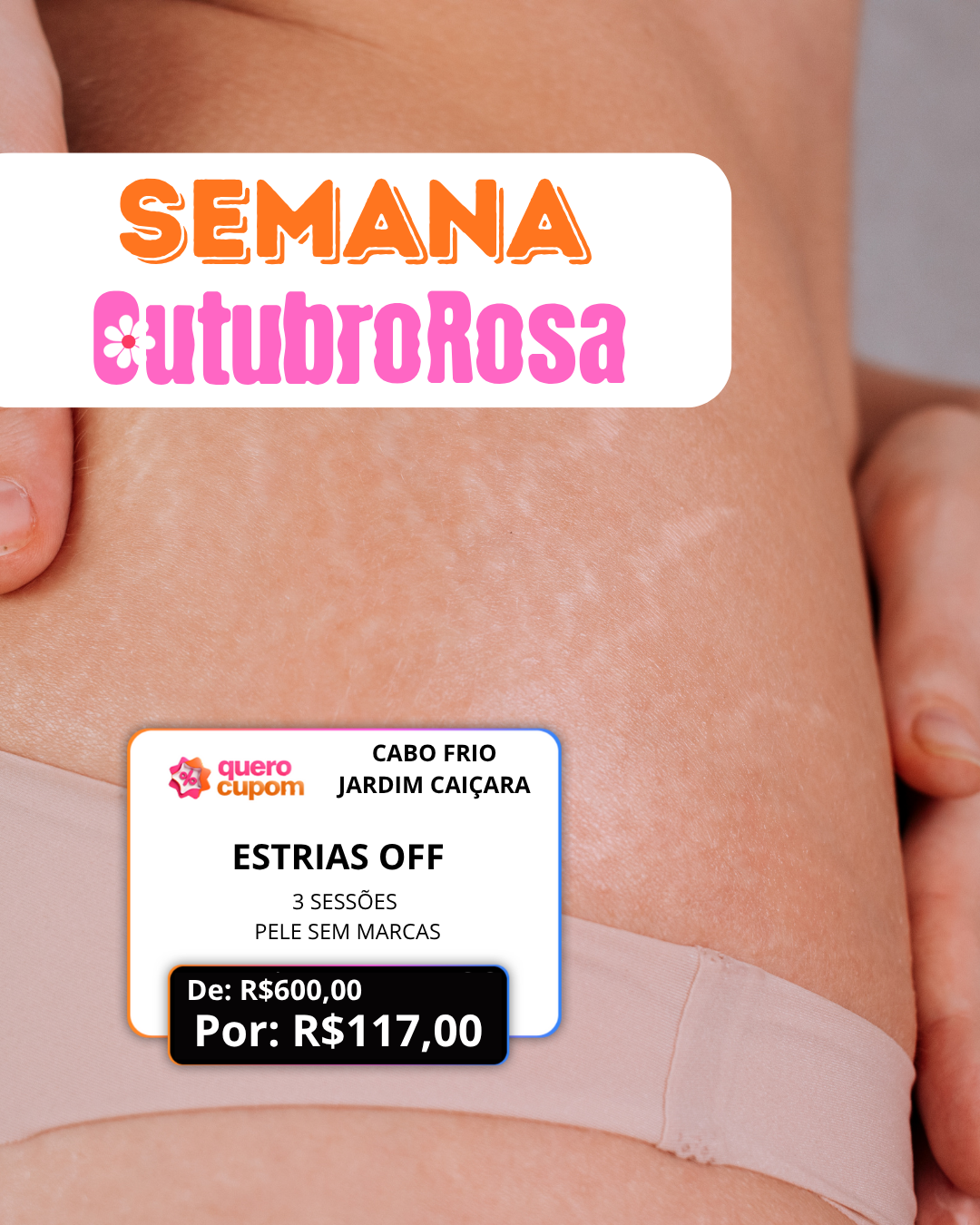 ESTRIAS OFF - PELE SEM MARCAS - 3 SESSÕES POR R$117