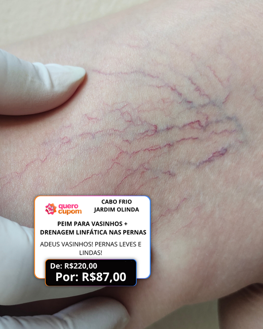 💉 ADEUS VASINHOS! PERNAS LEVES E LINDAS! 💫