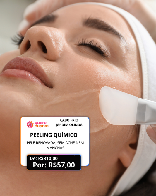 🌟 PEELING QUÍMICO – PELE RENOVADA, SEM ACNE NEM MANCHAS! 🌟