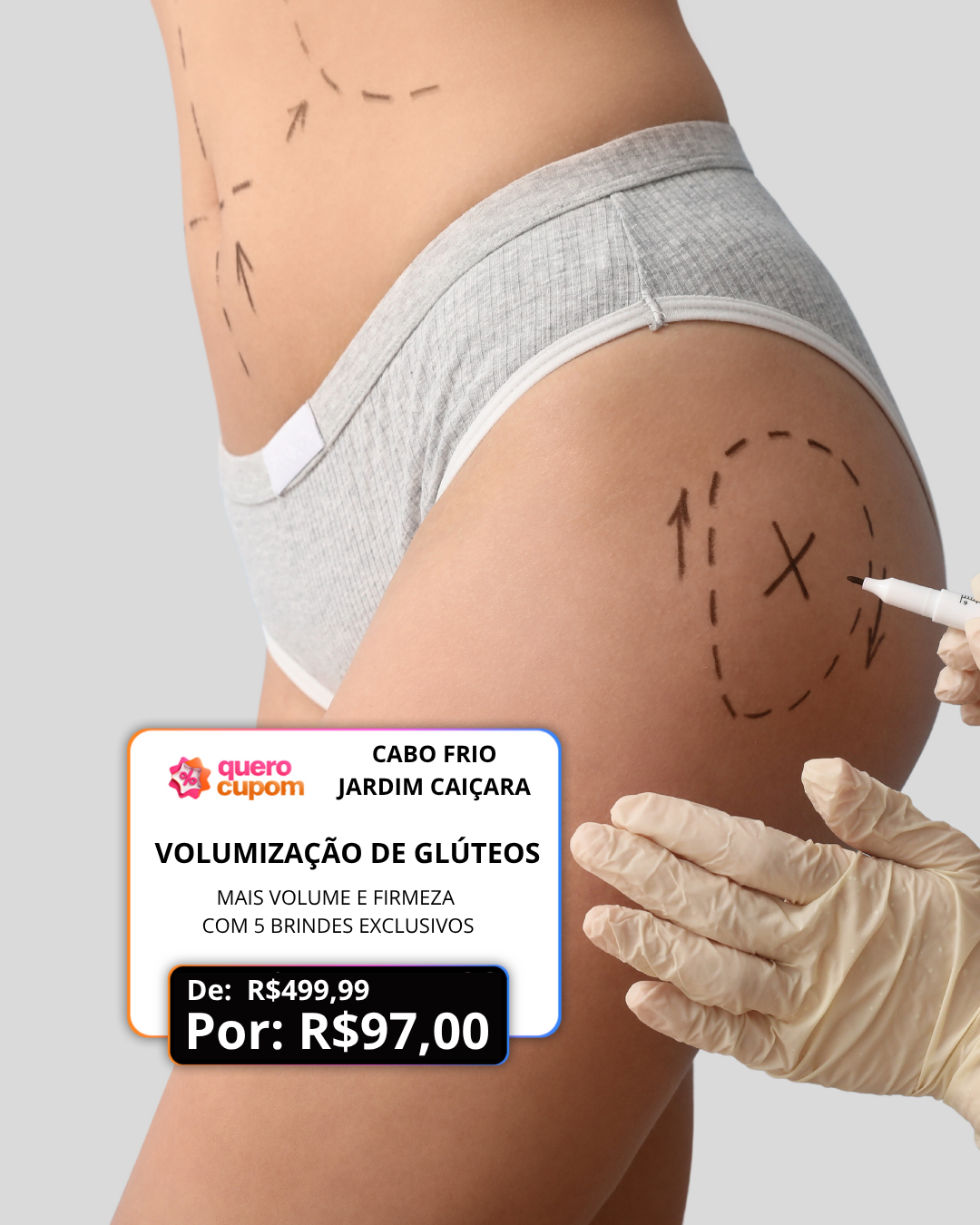 VOLUMIZAÇÃO DE GLÚTEOS – MAIS VOLUME E FIRMEZA POR APENAS R$ 97 COM BRINDE EXCLUSIVO!